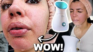 I Tested The Best FACIAL STEAMER On Amazon [upl. by Larina482]