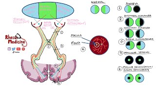 Visual Field Defects and Optic Nerve Pathway  Homonymous Hemianopia Bitemporal Hemianopia NEW 2020 [upl. by Isus]