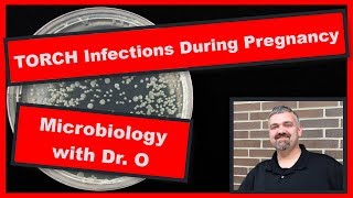 TORCH Infections During Pregnancy Microbiology [upl. by Graeme]