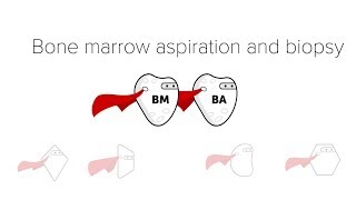 Bone Marrow Biopsy amp Aspiration BMBx [upl. by Westmoreland]