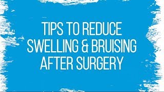 Tips to Reduce Swelling amp Bruising After Surgery [upl. by Adan]