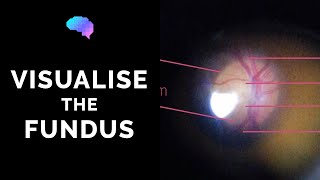 Fundoscopy  How to Visualise the Fundus  Direct Ophthalmoscopy  OSCE Guide  UKMLA  CPSA [upl. by Elery]