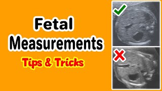 Fetal Measurements Tips and Tricks [upl. by Layney]