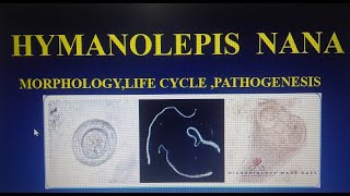 HYMENOLEPIS NANADWARF TAPE WORMMORPHOLOGY LIFECYCLE amp PATHOGENESIS [upl. by Tarkany629]