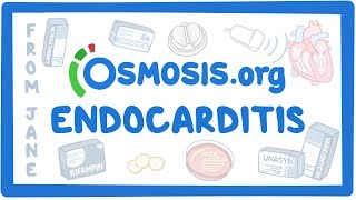 Clinicians Corner Endocarditis [upl. by Ebba]