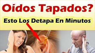 OIDOS TAPADOS Como Destapar Un Oido En Minutos Con Estos Increíblemente Efectivos Remedios [upl. by Gapin]