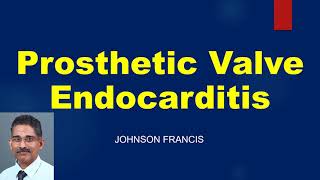 Prosthetic Valve Endocarditis  Important Aspects [upl. by Aiela]