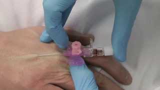 Cannulation How to gain IV access [upl. by Zigrang867]