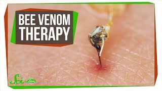 The Problem with Bee Venom Therapy [upl. by Faustina]