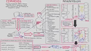 CIRRHOSIS END STAGE ALCOHOL CIRRHOSIS MY EXPERIENCE [upl. by Ariel]