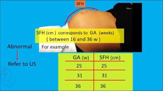 Symphysis Fundal Height  SFH  measurement [upl. by Alper404]