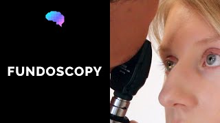 Fundoscopy Ophthalmoscopy  OSCE Guide  UKMLA  CPSA  PLAB 2 [upl. by Aneerhs]