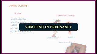 Vomiting in pregnancy  medicos [upl. by Yrram]