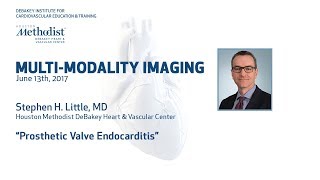 Prosthetic Valve Endocarditis STEPHEN H LITTLE MD June 13 2017 [upl. by Odraner]