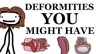 Deformities That You Might Have [upl. by Ardnwahs]