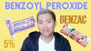 Benzac Benzoyl Peroxide 5 Review for Acne Philippines [upl. by Furey]