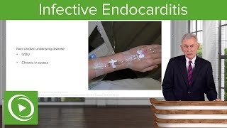 Infective Endocarditis IE Definition amp Epidemiology– Infectious Diseases  Lecturio [upl. by Khalin]