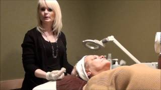 Chemical Peel Demonstration [upl. by Asirap406]