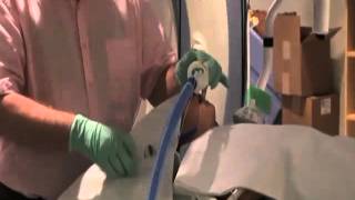 Laryngeal Mask Airway LMA Insertion in Pediatrics [upl. by Nehgaem]