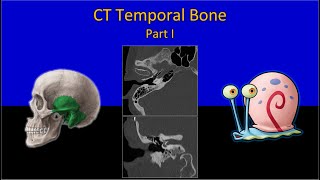 CT Temporal Bone Made Easy Part 1  Step by Step Approach [upl. by Ahsian]