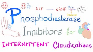 Intermittent Claudications Management [upl. by Kalb328]