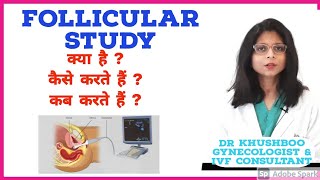 Follicular Study क्या होती है Hindi  Dr Khushboo  Mannat IVF Patna [upl. by Beau]