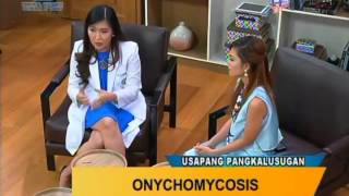 Good Morning Kuya Onychomycosis Fungal Nail Infection [upl. by Watt593]