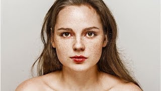 How to Grow Freckles Naturally and Safely [upl. by Kenaz]