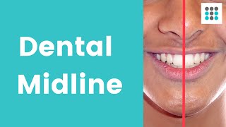 DENTAL MIDLINE SHIFT What why and how to correct l Dr Melissa Bailey [upl. by Airotnes]