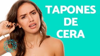 REMEDIOS CASEROS para los TAPONES DE CERA en los OÍDOS [upl. by Dominga]