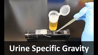 Urine Specific Gravity Refractometer [upl. by Ahsinauj]