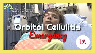 Orbital Cellulitis Emergency [upl. by Cecilla475]