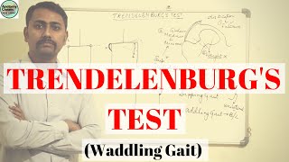 Trendelenburgs Test I Waddling Gait [upl. by Truc]