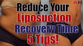 Liposuction Recovery Care  Reduce Your Liposuction Surgery Recovery Time  5 Tips [upl. by Ennaeed]