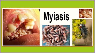 myiasis [upl. by Emerald]