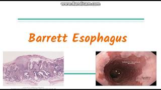 Barrett Esophagus [upl. by Eninotna777]