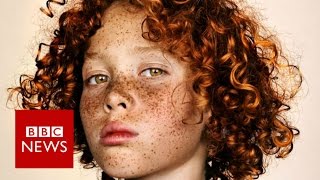 Celebrating freckles in all their glory  BBC News [upl. by Olive]