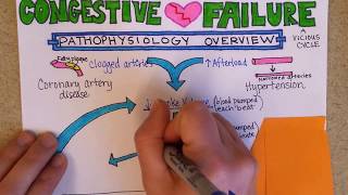 Congestive Heart Failure Pathophysiology [upl. by Ahsenod664]